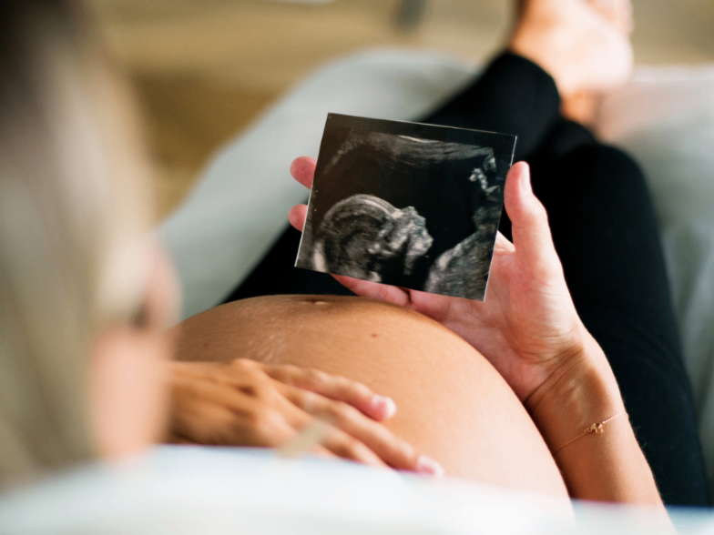 Femcare ultraljudsbild